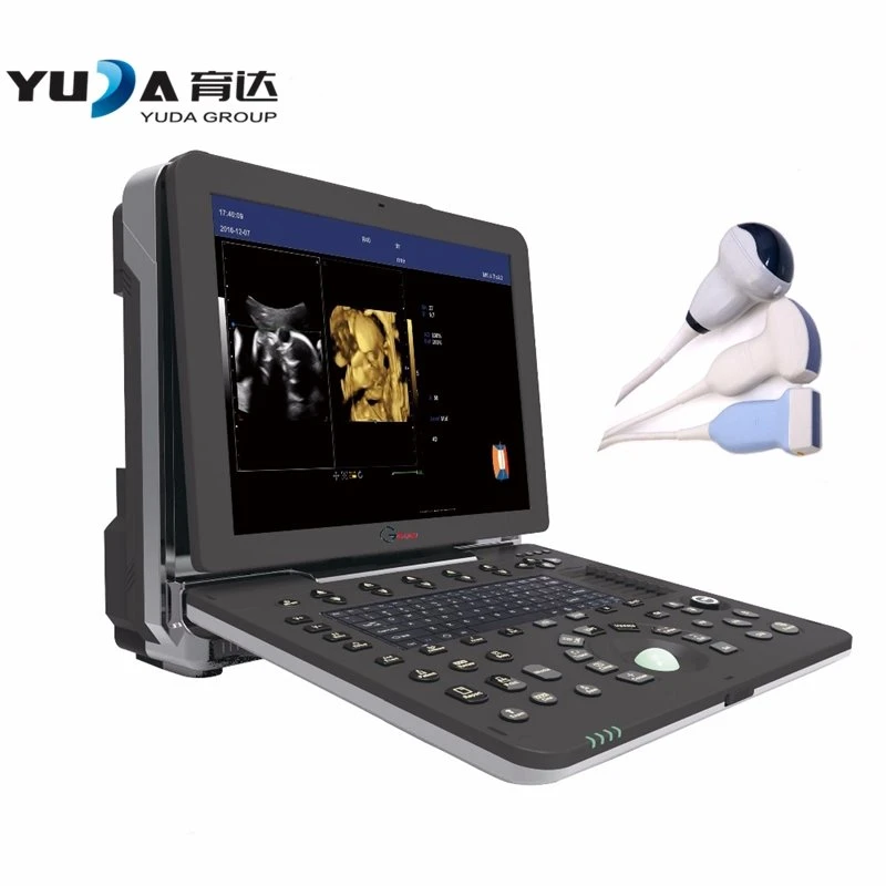 Clínica 15 pulgadas LCD portátil ordenador portátil color ultrasonido