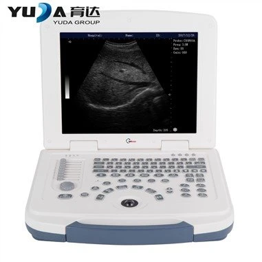 Escáner 3D de ultrasonido de alta gama portátil digital completo